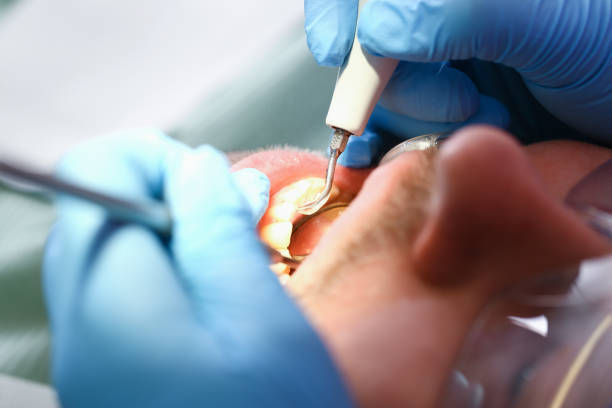 Best Walk-In Emergency Dentist in Farmington, IL