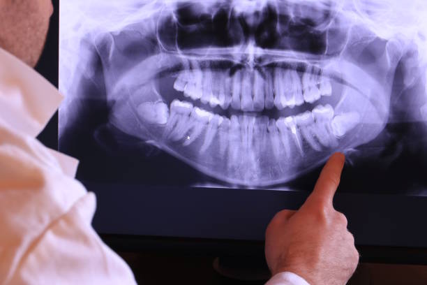 Best Emergency Treatment for Toothache in Farmington, IL