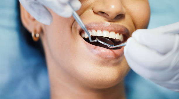 Best Emergency Tooth Extraction in Farmington, IL