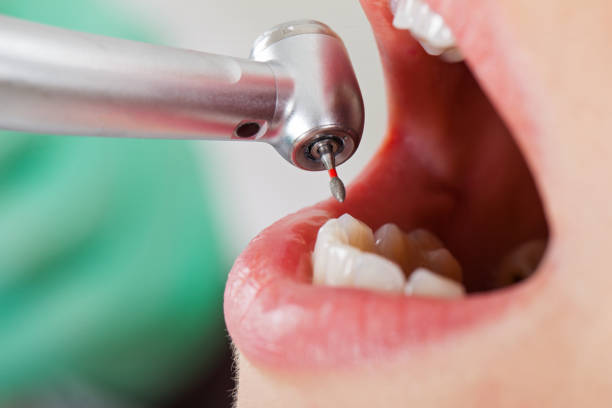 Best Walk-In Emergency Dentist in Farmington, IL